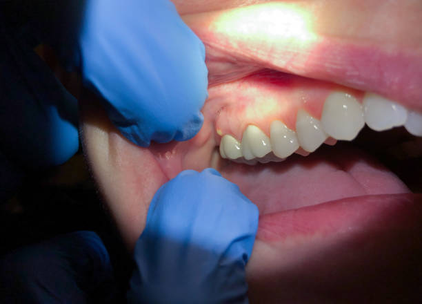 Best Mobile Emergency Dentist in Clare, MI