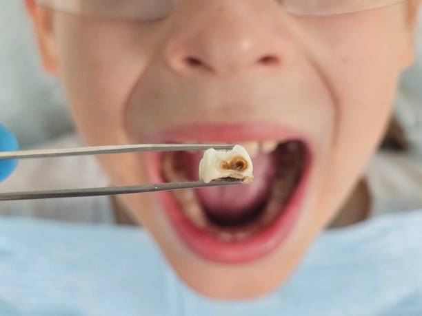 Best Weekend Emergency Dentist in Clare, MI
